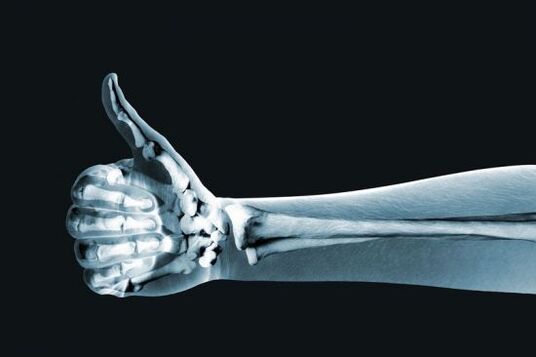 X-ray untuk mendiagnosis kesakitan pada sendi jari