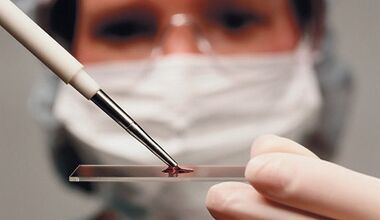 Diagnosis pembezaan atribut dan arthrosis