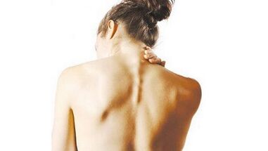 Gejala osteochondrosis tulang belakang serviks